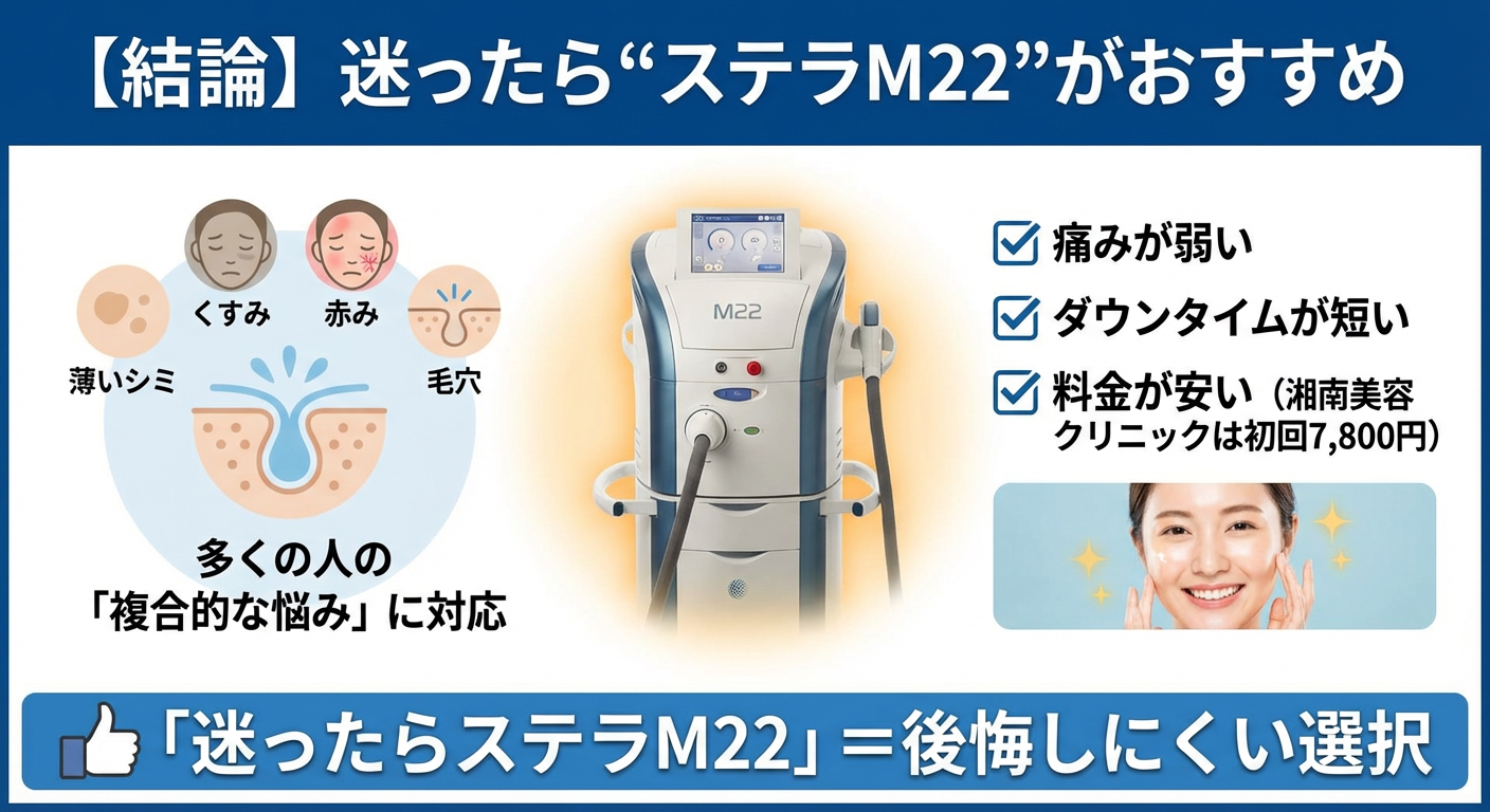 迷ったら“ステラM22”がおすすめ